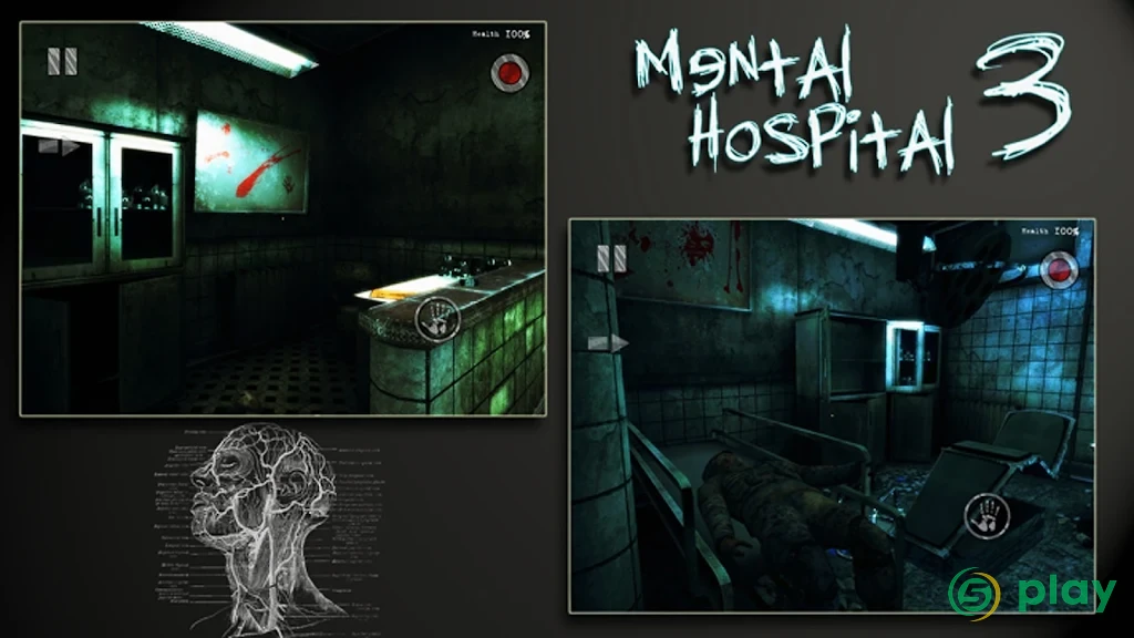 Mental Hospital III Remastered — скриншот 1